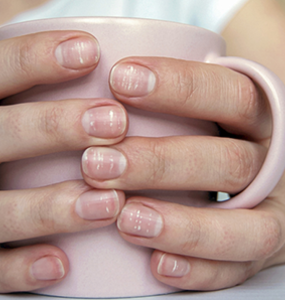 Your fingernails and toenails and cancer