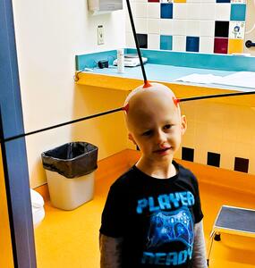 Theo so bald that arrows stick to his head during pediatric blood cancer treatment
