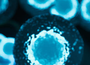 Blue Cells